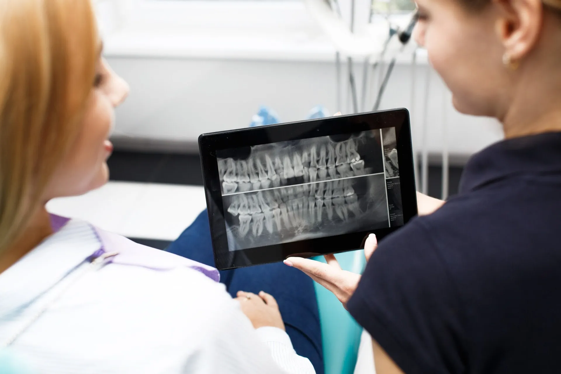 Digital dental X-ray equipment