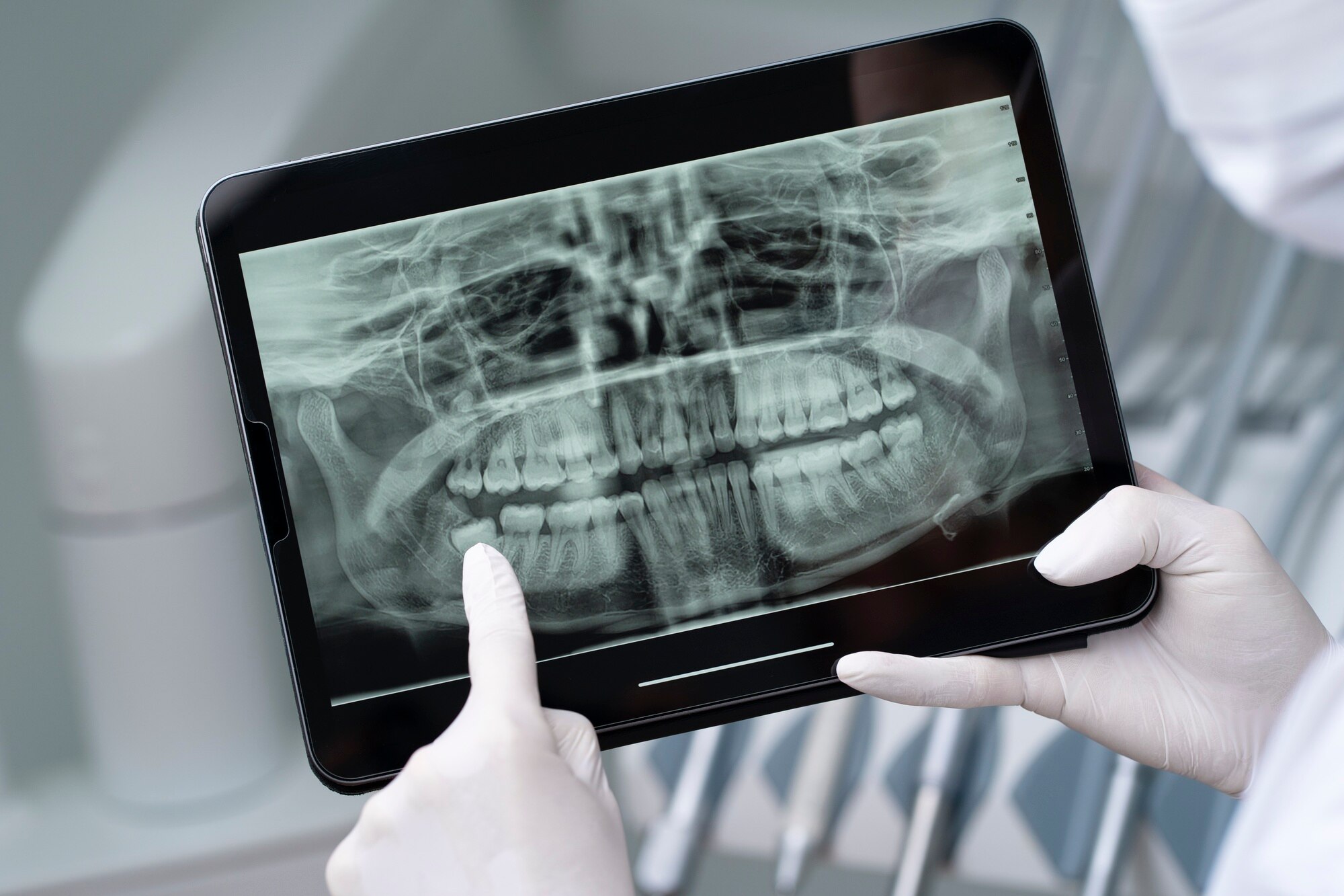 Digital dental radiography in action